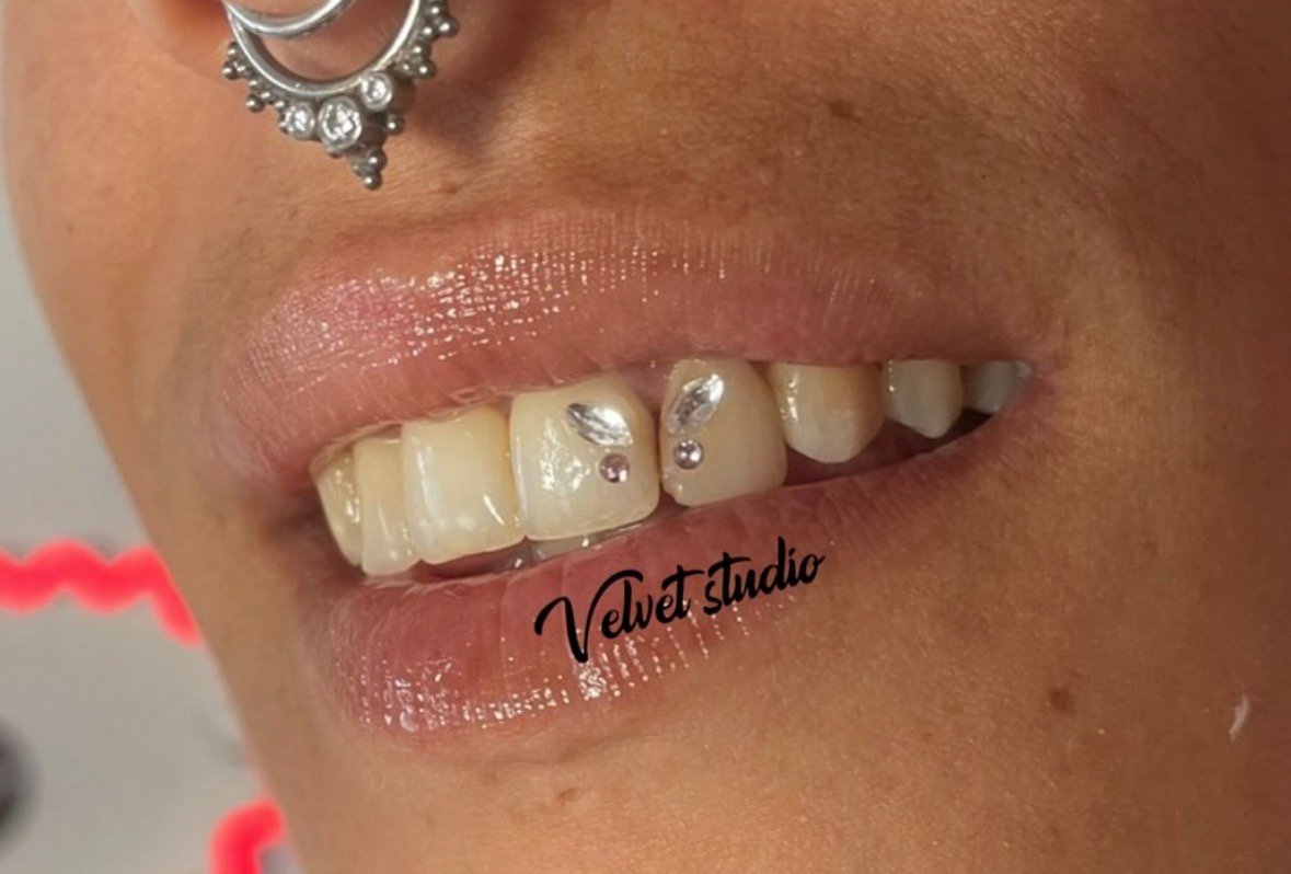 Resultado tratamiento facial